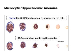 Normocytic Rbc Hematology: Blood and Complete Blood Count | PPT
