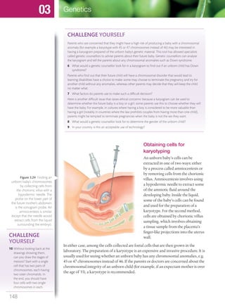 Obtaining cells for
karyotyping
An unborn baby’s cells can be
extracted in one of two ways: either
by a process called amniocentesis or
by removing cells from the chorionic
villus. Amniocentesis involves using
a hypodermic needle to extract some
of the amniotic fluid around the
developing baby. Inside the liquid,
some of the baby’s cells can be found
and used for the preparation of a
karyotype. For the second method,
cells are obtained by chorionic villus
sampling, which involves obtaining
a tissue sample from the placenta’s
finger-like projections into the uterus
wall.
In either case, among the cells collected are foetal cells that are then grown in the
laboratory. The preparation of a karyotype is an expensive and invasive procedure. It is
usually used for seeing whether an unborn baby has any chromosomal anomalies, e.g.
45 or 47 chromosomes instead of 46. If the parents or doctors are concerned about the
chromosomal integrity of an unborn child (for example, if an expectant mother is over
the age of 35), a karyotype is recommended.
CHALLENGE
YOURSELF
10 Without looking back at the
drawings showing them,
can you draw the stages of
meiosis? Start with a single
cell that has two pairs of
chromosomes, each having
two sister chromatids. In
the end, you should have
four cells with two single
chromosomes in each.
Figure 3.24 Finding an
unborn baby’s chromosomes
by collecting cells from
the chorionic villus with a
hypodermic needle. The
probe on the lower part of
the future mother’s abdomen
is the sonogram probe. An
amniocentesis is similar
except that the needle would
extract cells from the liquid
surrounding the embryo.
CHALLENGE YOURSELF
Parents who are concerned that they might have a high risk of producing a baby with a chromosomal
anomaly (for example a karyotype with 45 or 47 chromosomes instead of 46) may be interested in
having a karyogram prepared of the unborn baby’s genetic material. This tool has allowed specialists
called genetic counsellors to advise parents about their future baby. Genetic counsellors can analyse
the karyogram and tell the parents about any chromosomal anomalies such as Down syndrome.
6 What would a genetic counsellor look for in a karyogram to ﬁnd out if an unborn child has Down
syndrome?
Parents who ﬁnd out that their future child will have a chromosomal disorder that would lead to
learning disabilities have a choice to make: some may choose to terminate the pregnancy and try for
another child without any anomalies, whereas other parents may decide that they will keep the child
no matter what.
7 What factors do parents use to make such a difﬁcult decision?
Here is another difﬁcult issue that raises ethical concerns: because a karyogram can be used to
determine whether the future baby is a boy or a girl, some parents use this to choose whether they will
have the baby. For example, in cultures where having a boy is considered to be more valuable than
having a girl (notably in countries where the law prohibits couples from having more than one child),
parents might be tempted to terminate pregnancies when the baby is not the sex they want.
8 What would a genetic counsellor look for to determine the gender of the unborn child?
9 In your country, is this an acceptable use of technology?
148
Genetics03
M03_BIO_SB_IBDIP_9045_U03.indd 148 26/09/2014 12:11
 