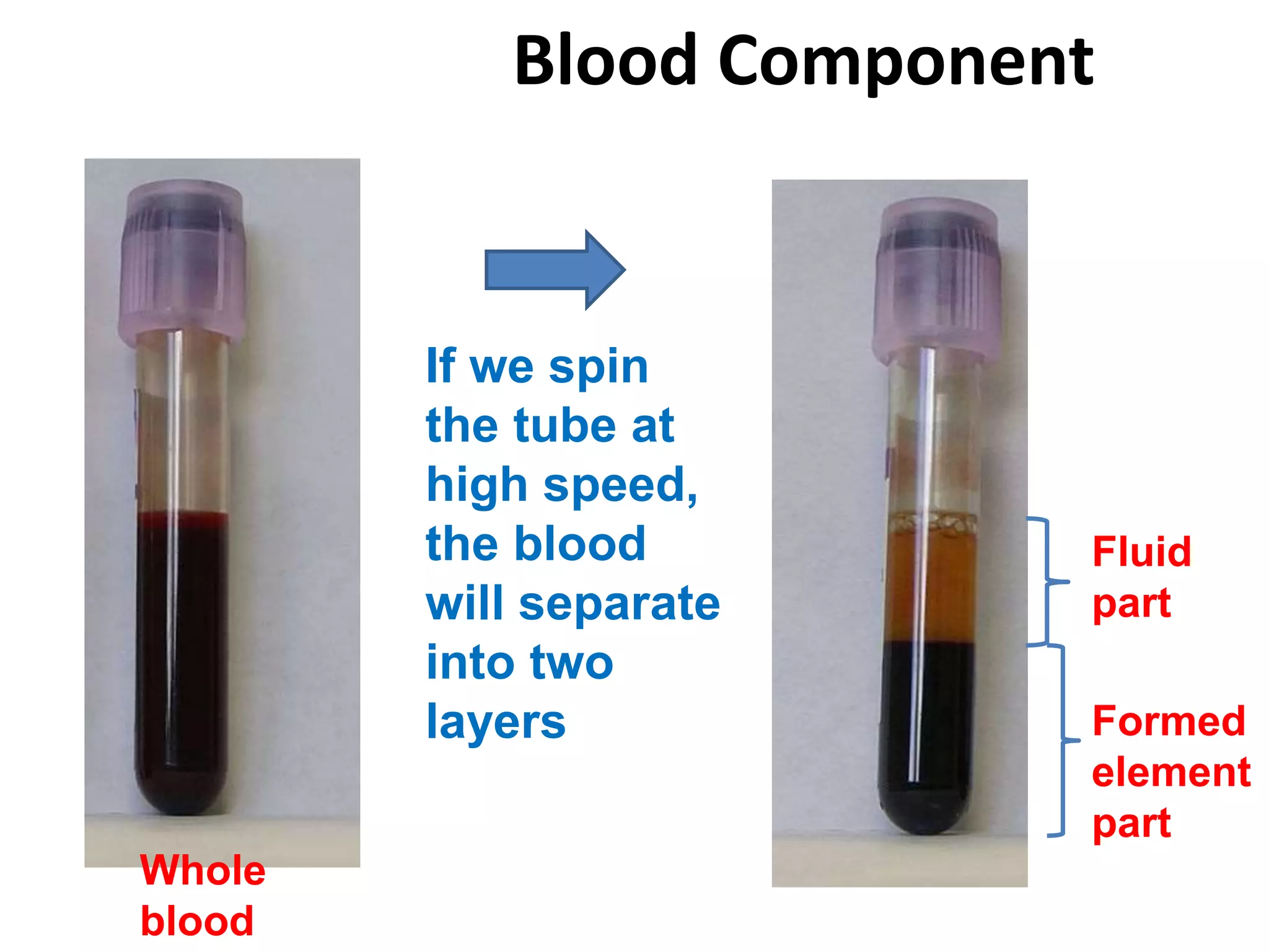 Blood Component
Whole
blood
If we spin
the tube at
high speed,
the blood
will separate
into two
layers
Fluid
part
Formed
element
part
 