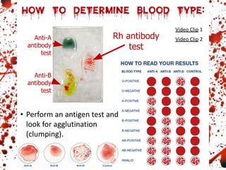Rh antibody
test
Anti-B
antibody
test
Anti-A
antibody
test
• Perform an antigen test and
look for agglutination
(clumping).
Video Clip 2
Video Clip 1
 