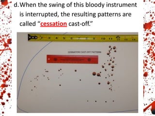 d.When the swing of this bloody instrument
is interrupted, the resulting patterns are
called “cessation cast-off.”
 