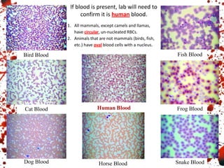 Bird Blood
Cat Blood
Dog Blood
Fish Blood
Frog Blood
Snake Blood
Horse Blood
If blood is present, lab will need to
confirm it is human blood.
1. All mammals, except camels and llamas,
have circular, un-nucleated RBCs.
2. Animals that are not mammals (birds, fish,
etc.) have oval blood cells with a nucleus.
 