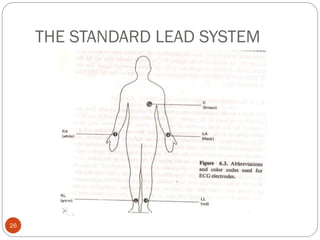 THE STANDARD LEAD SYSTEM
26
 