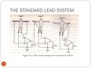 THE STANDARD LEAD SYSTEM
30
Figure.6.4.1.Three lead techniques for measurement of ECG
 