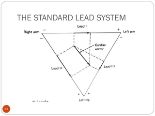 THE STANDARD LEAD SYSTEM
33
 