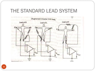 THE STANDARD LEAD SYSTEM
35
 