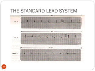 THE STANDARD LEAD SYSTEM
38
 
