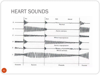 HEART SOUNDS
61
 