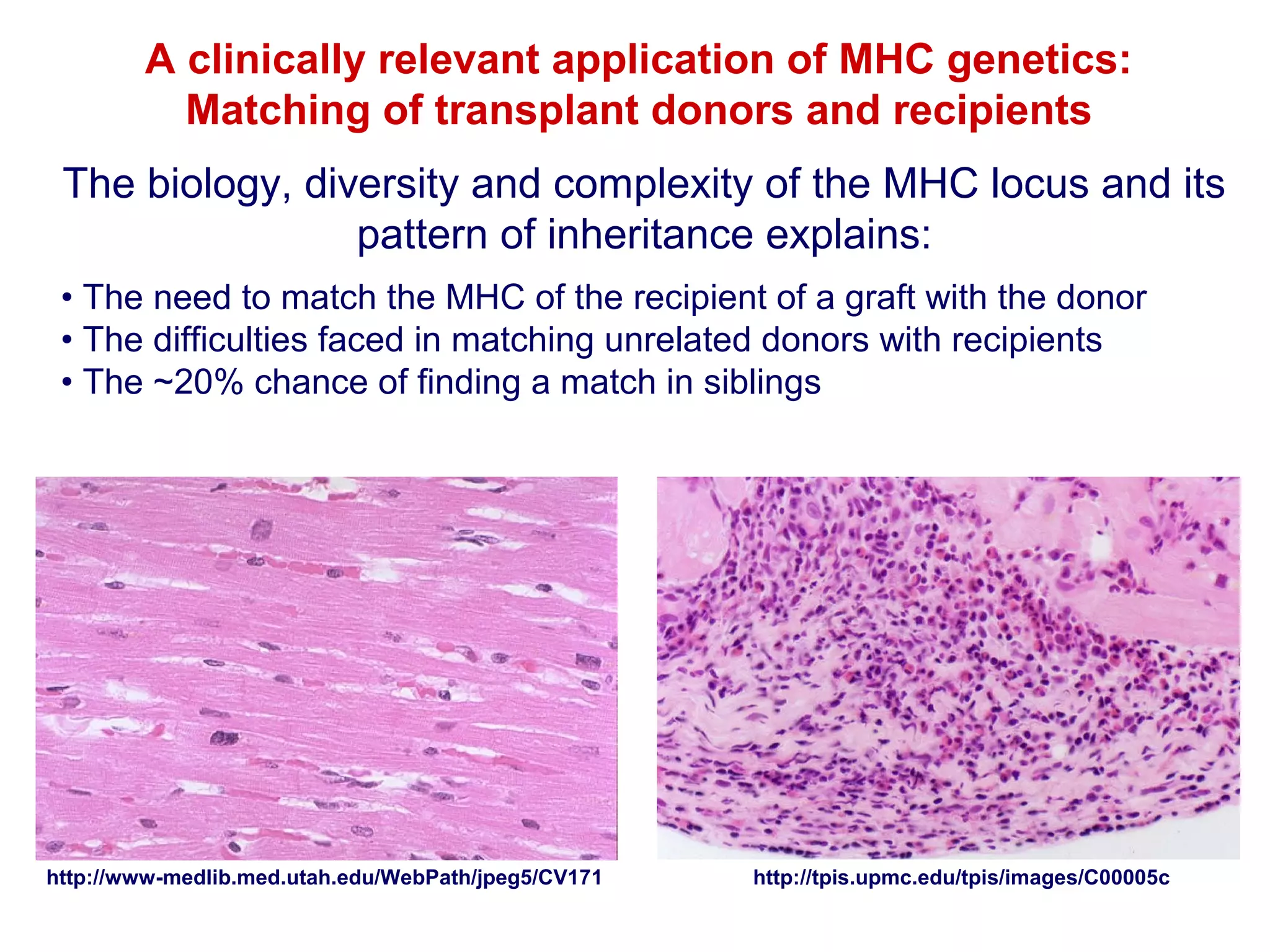 A clinically relevant application of MHC genetics:
Matching of transplant donors and recipients
The biology, diversity and complexity of the MHC locus and its
pattern of inheritance explains:
• The need to match the MHC of the recipient of a graft with the donor
• The difficulties faced in matching unrelated donors with recipients
• The ~20% chance of finding a match in siblings

http://www-medlib.med.utah.edu/WebPath/jpeg5/CV171

http://tpis.upmc.edu/tpis/images/C00005c

 