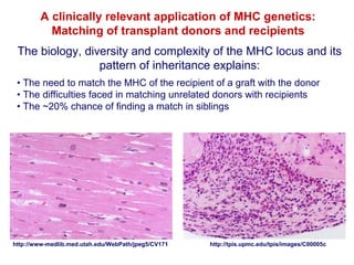 A clinically relevant application of MHC genetics:
Matching of transplant donors and recipients
The biology, diversity and complexity of the MHC locus and its
pattern of inheritance explains:
• The need to match the MHC of the recipient of a graft with the donor
• The difficulties faced in matching unrelated donors with recipients
• The ~20% chance of finding a match in siblings

http://www-medlib.med.utah.edu/WebPath/jpeg5/CV171

http://tpis.upmc.edu/tpis/images/C00005c

 