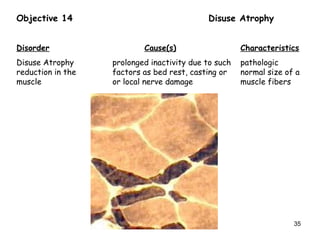 Objective 14 Disuse Atrophy
Disorder Cause(s) Characteristics
Disuse Atrophy prolonged inactivity due to such pathologic
reduction in the factors as bed rest, casting or normal size of a
muscle or local nerve damage muscle fibers
35
 