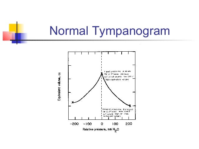 types of tympanograms types of tympanograms