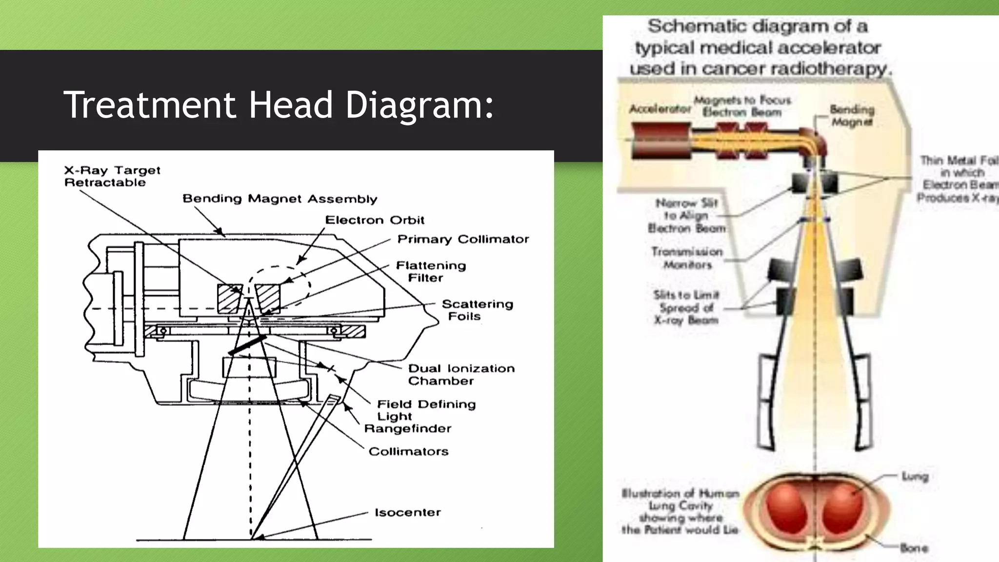 Treatment Head Diagram:
 