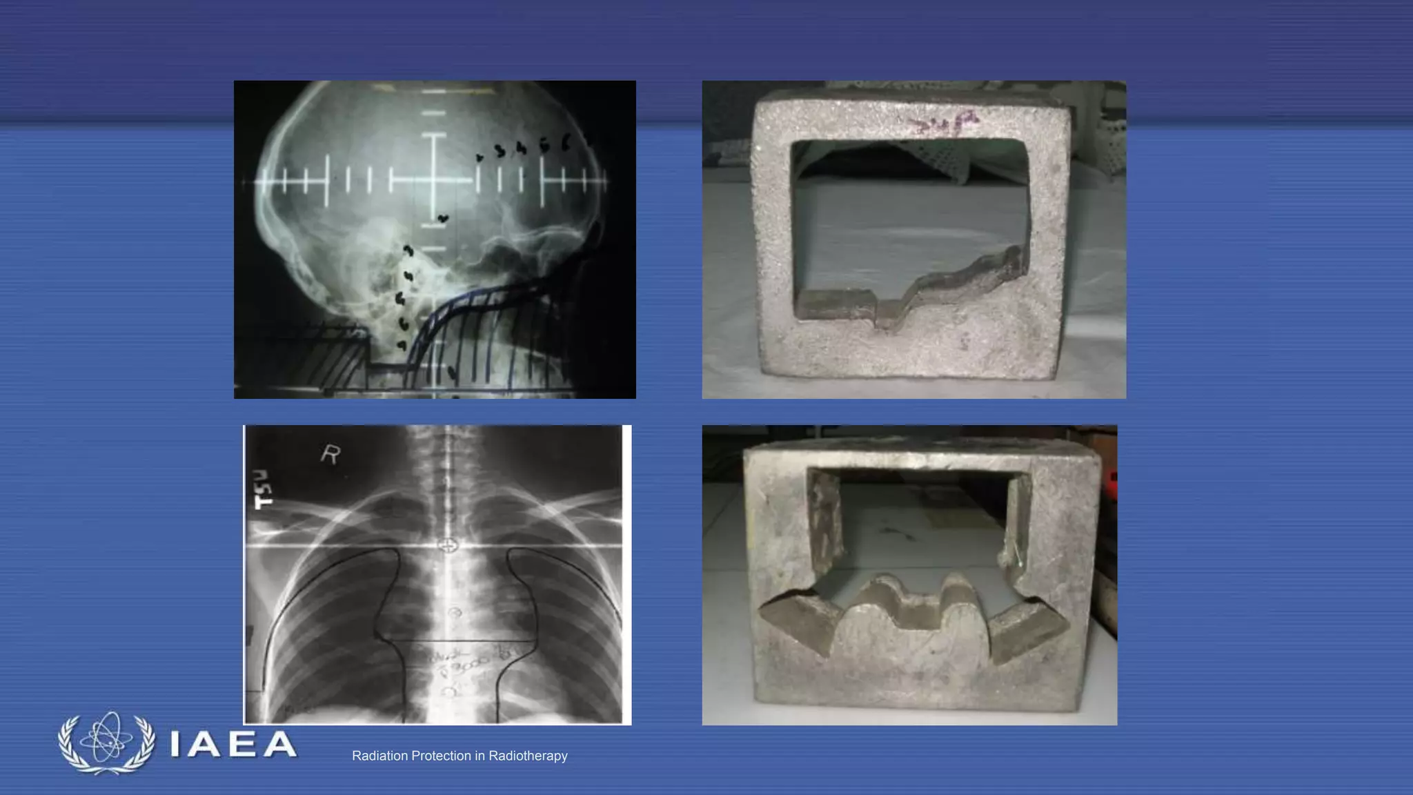 Radiation Protection in Radiotherapy
 