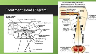 Treatment Head Diagram:
 