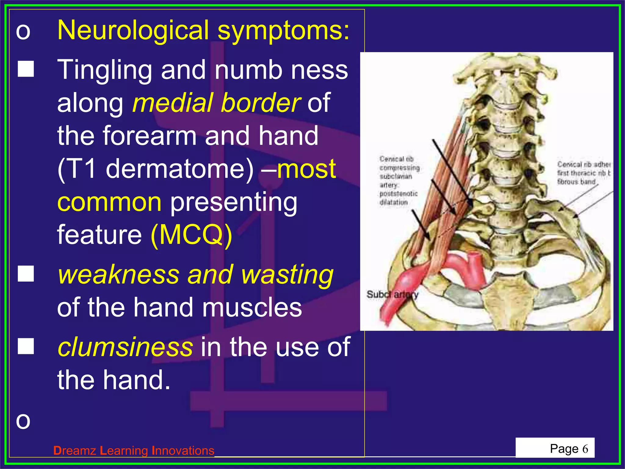 Topic 60 CERVICAL RIB.ppt