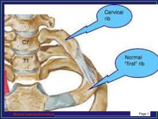 Topic 60 CERVICAL RIB.ppt