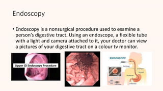 Endoscopy
• Endoscopy is a nonsurgical procedure used to examine a
person’s digestive tract. Using an endoscope, a flexible tube
with a light and camera attached to it, your doctor can view
a pictures of your digestive tract on a colour tv monitor.
 