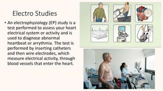Electro Studies
• An electrophysiology (EP) study is a
test performed to assess your heart
electrical system or activity and is
used to diagnose abnormal
heartbeat or arrythmia. The test is
performed by inserting catheters
and then wire electrodes, which
measure electrical activity, through
blood vessels that enter the heart.
 