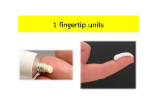 Finger Tip Unit.pdf Topical corticosteroids | PDF