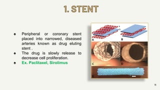1. STENT
11
♠ Peripheral or coronary stent
placed into narrowed, diseased
arteries known as drug eluting
stent .
♠ The drug is slowly release to
decrease cell proliferation.
♠ Ex. Paclitaxel, Sirolimus
 