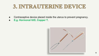 3. INTRAUTERINE DEVICE
13
♠ Contraceptive device placed inside the uterus to prevent pregnancy.
♠ E.g. Hormonal IUD, Copper T.
 