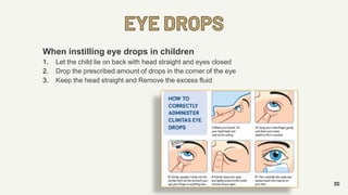 EYE DROPS
30
When instilling eye drops in children
1. Let the child lie on back with head straight and eyes closed
2. Drop the prescribed amount of drops in the corner of the eye
3. Keep the head straight and Remove the excess fluid
 