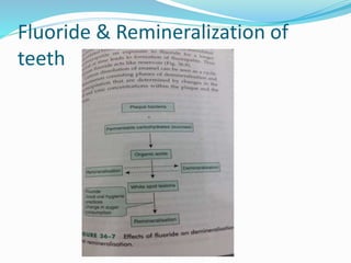 Fluoride & Remineralization of
teeth
 