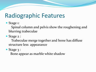 Radiographic Features
 Stage 1:
Spinal column and pelvis show the roughening and
blurring trabeculae
 Stage 2 :
Trabeculae merge together and bone has diffuse
structure less appearance
 Stage 3 :
Bone appear as marble white shadow
 