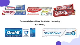 Topical Fluorides as Preventive Aid of Dental Caries in Children | PPTX