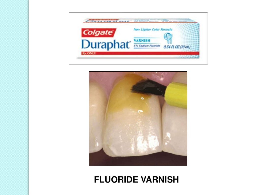 Topical fluorides in dentistry