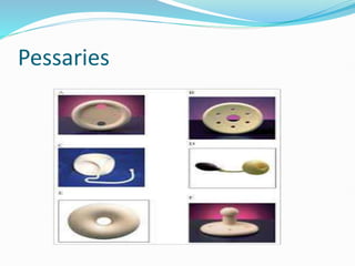 Pessaries
 