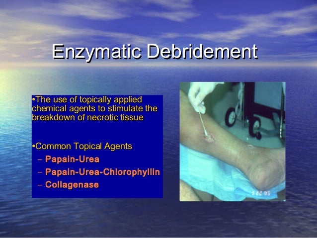 wound topical debridement enzymatic