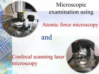 Microscopic examination using Atomic force microscopy and Confocal ...