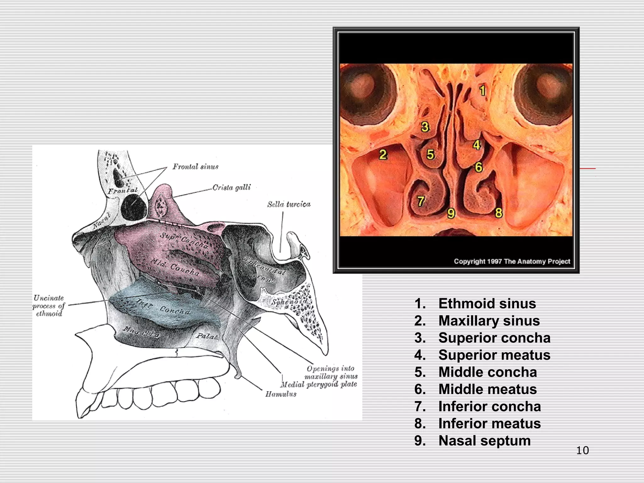 10
1. Ethmoid sinus
2. Maxillary sinus
3. Superior concha
4. Superior meatus
5. Middle concha
6. Middle meatus
7. Inferior concha
8. Inferior meatus
9. Nasal septum
 