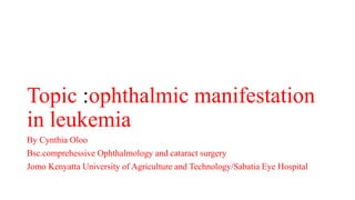 Topic :ophthalmic manifestation
in leukemia
By Cynthia Oloo
Bsc.comprehessive Ophthalmology and cataract surgery
Jomo Kenyatta University of Agriculture and Technology/Sabatia Eye Hospital
 