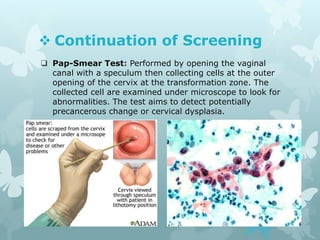  Continuation of Screening
 Pap-Smear Test: Performed by opening the vaginal
canal with a speculum then collecting cells at the outer
opening of the cervix at the transformation zone. The
collected cell are examined under microscope to look for
abnormalities. The test aims to detect potentially
precancerous change or cervical dysplasia.
 