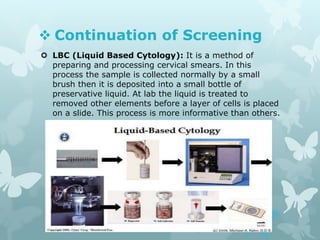  Continuation of Screening
 LBC (Liquid Based Cytology): It is a method of
preparing and processing cervical smears. In this
process the sample is collected normally by a small
brush then it is deposited into a small bottle of
preservative liquid. At lab the liquid is treated to
removed other elements before a layer of cells is placed
on a slide. This process is more informative than others.
 
