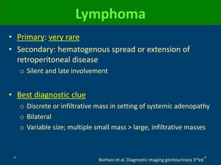 Lymphoma
Borhani et al, Diagnostic imaging genitourinary 3rded
• Primary: very rare
• Secondary: hematogenous spread or extension of
retroperitoneal disease
o Silent and late involvement
• Best diagnostic clue
o Discrete or infiltrative mass in setting of systemic adenopathy
o Bilateral
o Variable size; multiple small mass > large, infiltrative masses
 