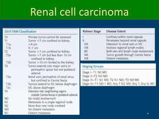 Renal cell carcinoma
 