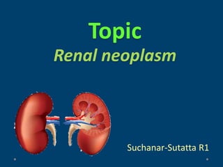 Topic
Renal neoplasm
Suchanar-Sutatta R1
 