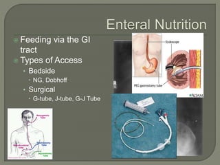  Feeding via the GI
tract
 Types of Access
• Bedside
 NG, Dobhoff
• Surgical
 G-tube, J-tube, G-J Tube
 