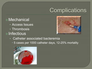 Mechanical
• Access Issues
• Thrombosis
Infectious
• Catheter associated bacteremia
 5 cases per 1000 catheter days, 12-25% mortality
 