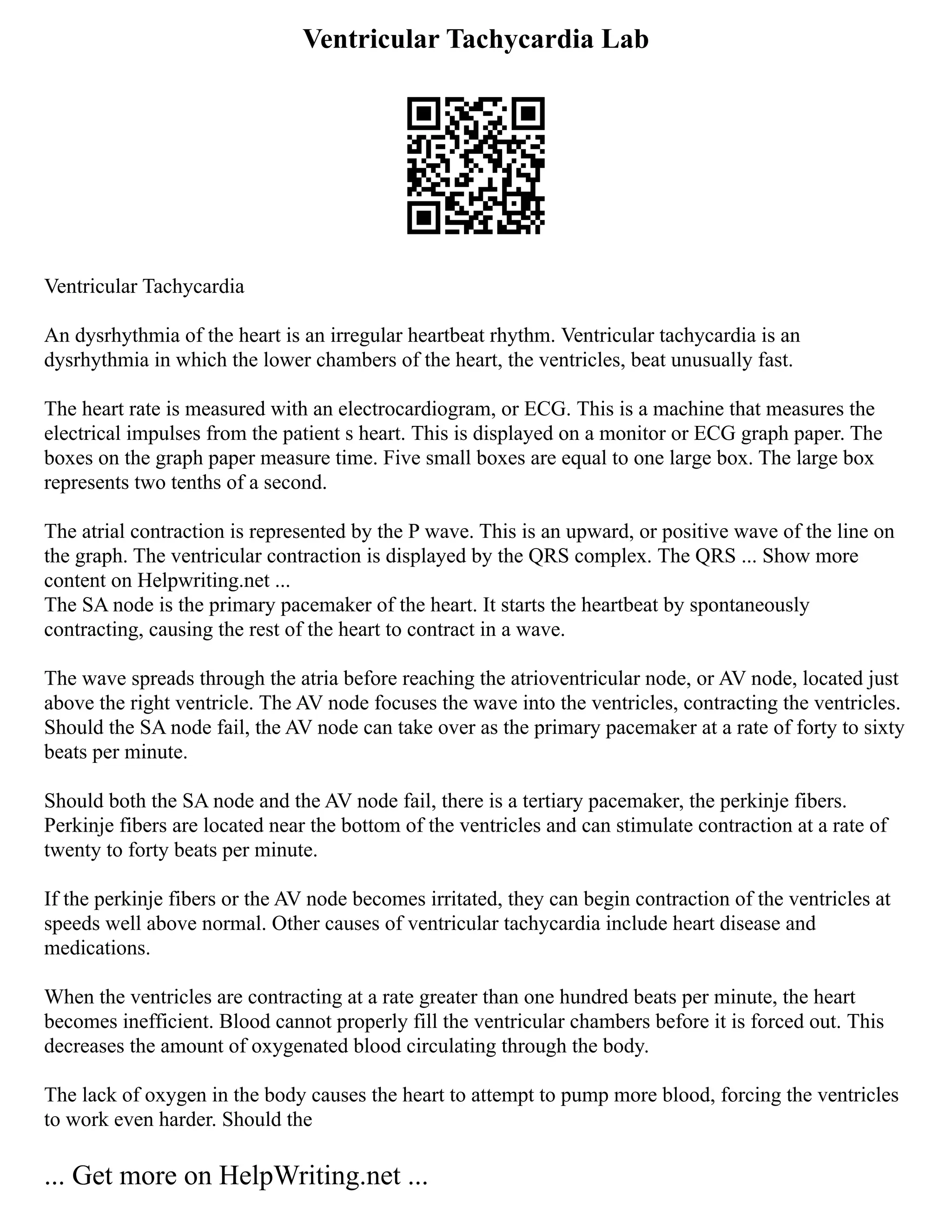 Ventricular Tachycardia Lab
Ventricular Tachycardia
An dysrhythmia of the heart is an irregular heartbeat rhythm. Ventricular tachycardia is an
dysrhythmia in which the lower chambers of the heart, the ventricles, beat unusually fast.
The heart rate is measured with an electrocardiogram, or ECG. This is a machine that measures the
electrical impulses from the patient s heart. This is displayed on a monitor or ECG graph paper. The
boxes on the graph paper measure time. Five small boxes are equal to one large box. The large box
represents two tenths of a second.
The atrial contraction is represented by the P wave. This is an upward, or positive wave of the line on
the graph. The ventricular contraction is displayed by the QRS complex. The QRS ... Show more
content on Helpwriting.net ...
The SA node is the primary pacemaker of the heart. It starts the heartbeat by spontaneously
contracting, causing the rest of the heart to contract in a wave.
The wave spreads through the atria before reaching the atrioventricular node, or AV node, located just
above the right ventricle. The AV node focuses the wave into the ventricles, contracting the ventricles.
Should the SA node fail, the AV node can take over as the primary pacemaker at a rate of forty to sixty
beats per minute.
Should both the SA node and the AV node fail, there is a tertiary pacemaker, the perkinje fibers.
Perkinje fibers are located near the bottom of the ventricles and can stimulate contraction at a rate of
twenty to forty beats per minute.
If the perkinje fibers or the AV node becomes irritated, they can begin contraction of the ventricles at
speeds well above normal. Other causes of ventricular tachycardia include heart disease and
medications.
When the ventricles are contracting at a rate greater than one hundred beats per minute, the heart
becomes inefficient. Blood cannot properly fill the ventricular chambers before it is forced out. This
decreases the amount of oxygenated blood circulating through the body.
The lack of oxygen in the body causes the heart to attempt to pump more blood, forcing the ventricles
to work even harder. Should the
... Get more on HelpWriting.net ...
 