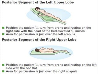 topic tracheobronchial tree upper airway.pptx