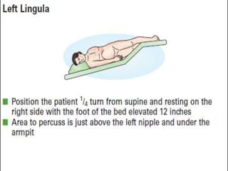 topic tracheobronchial tree upper airway.pptx