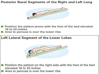 topic tracheobronchial tree upper airway.pptx