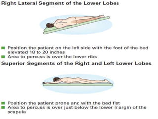 topic tracheobronchial tree upper airway.pptx
