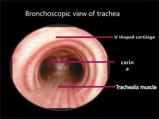 Bronchoscopic view of trachea
 