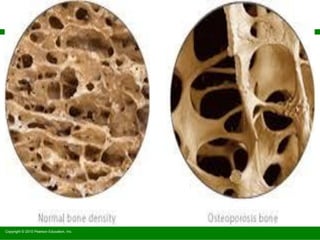 Copyright © 2010 Pearson Education, Inc.
 